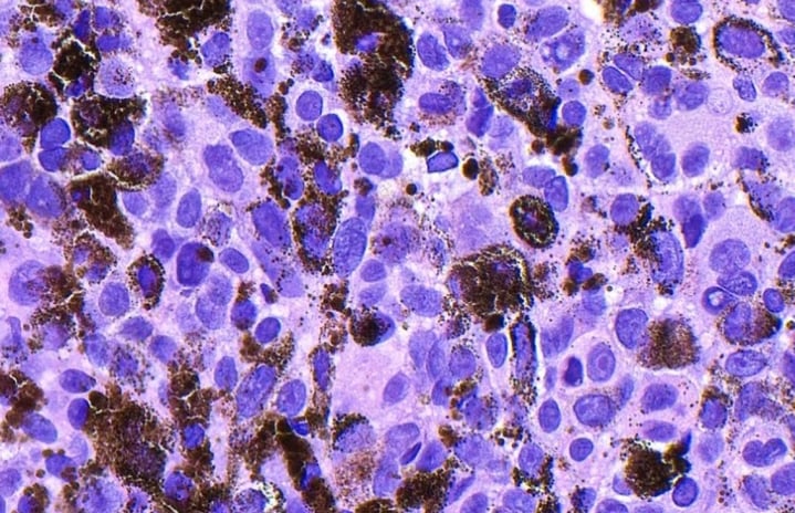 Featured Image